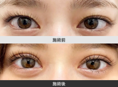 ドリーム・ダブル