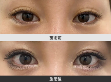 切らないタレ目