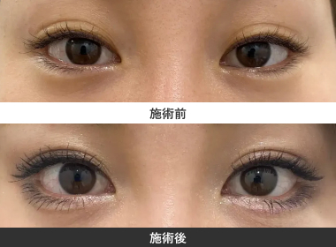 切らないタレ目